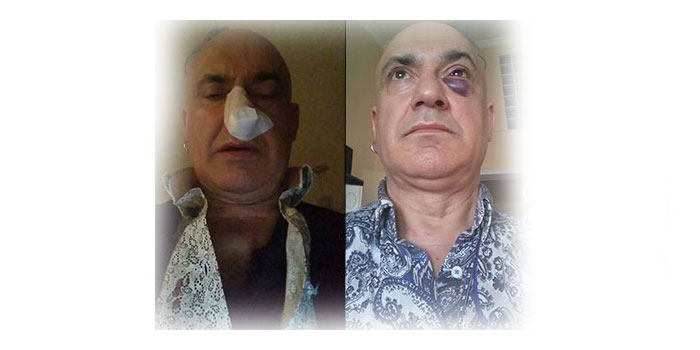 Yusuf Ziya Tom'u darp ettiler 