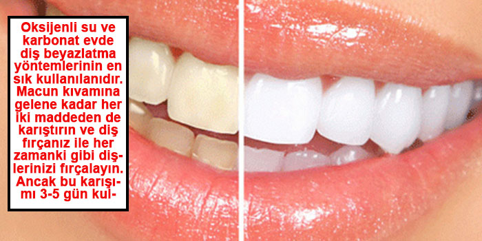 DİŞ BEYAZLATMANIN 5 FARKLI YOLU 
