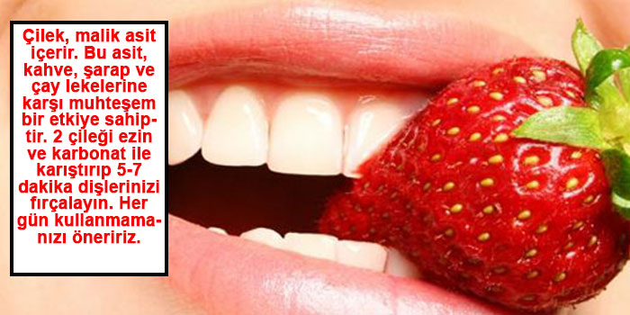 DİŞ BEYAZLATMANIN 5 FARKLI YOLU 