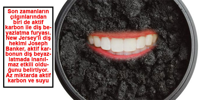 DİŞ BEYAZLATMANIN 5 FARKLI YOLU 